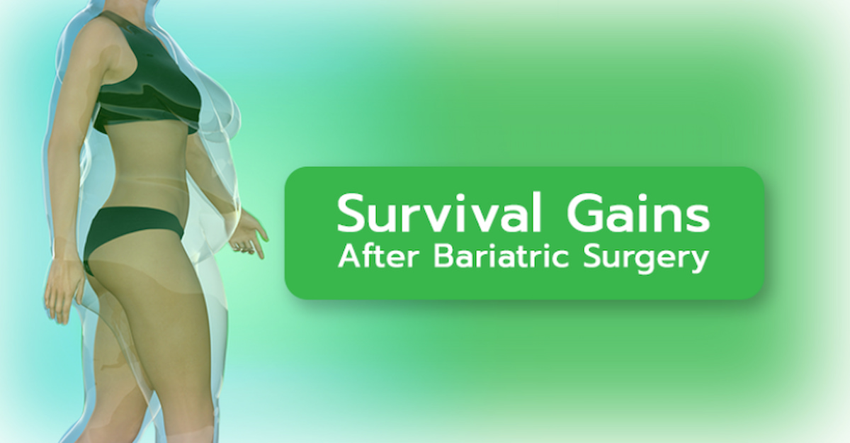 Weight Loss Surgery Survival Gains Blog